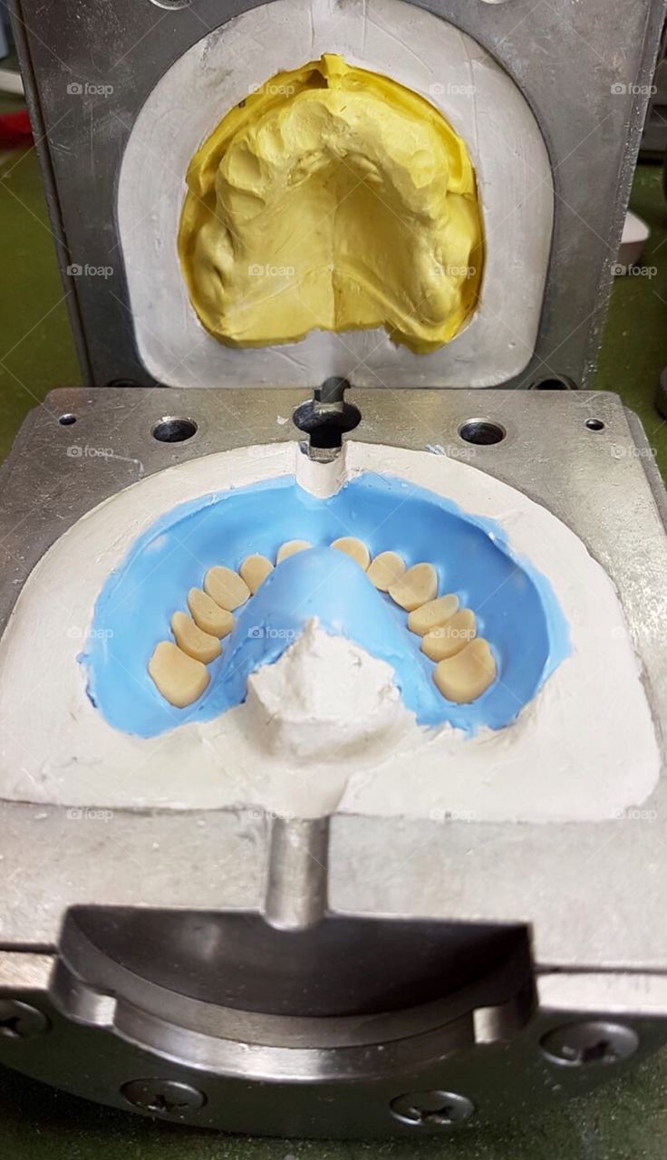 Dental Laboratory, Prosthesis, Teeth, Handmade Dental Prosthesis, Prosthetic 