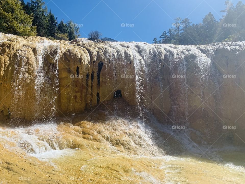 Calcification waterfall 