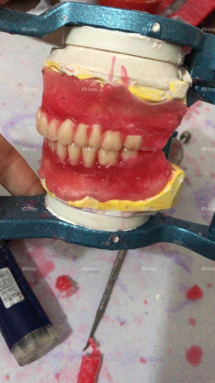 Dental 
