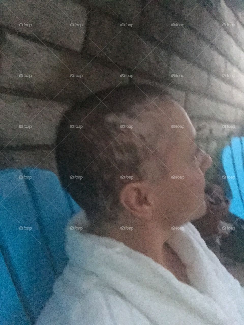 Hair coming out after chemo