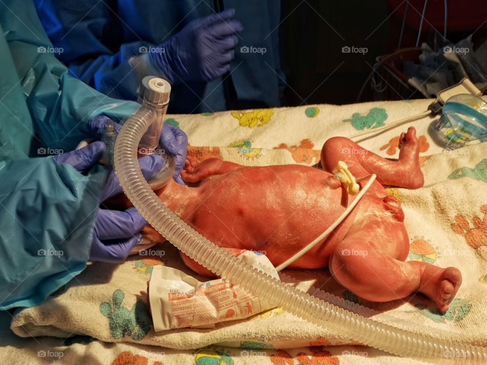 Newborn Premature Infant
