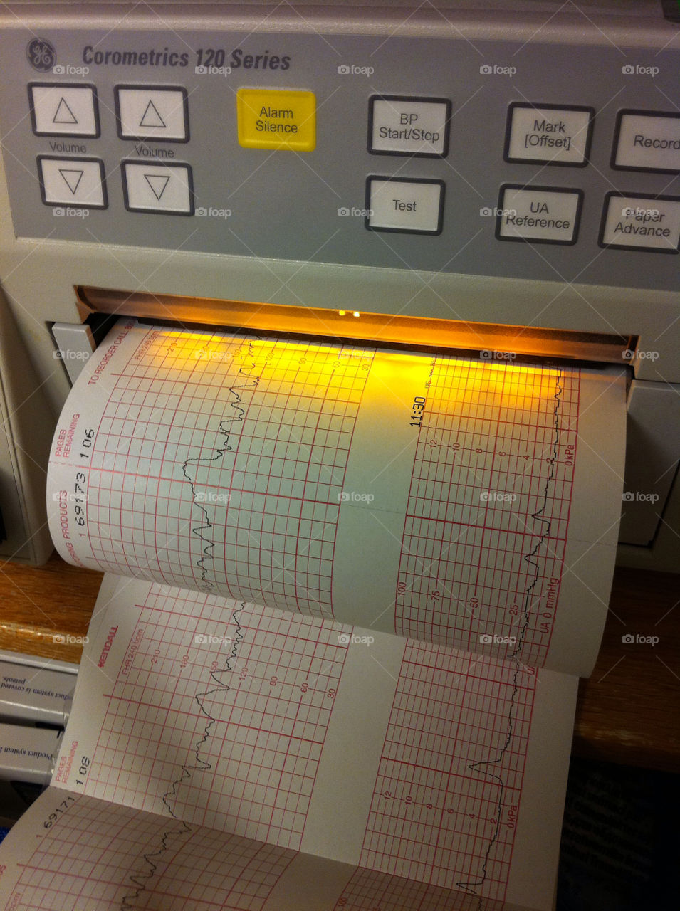 emergency heart monitor hospital by gene916