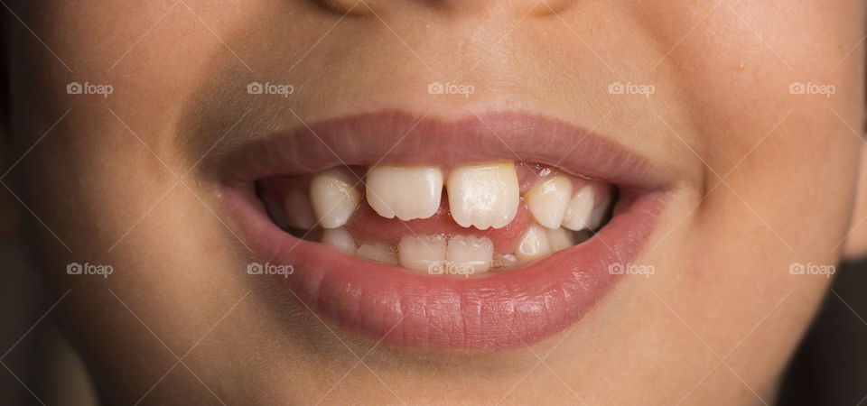 Close-up of human mouth