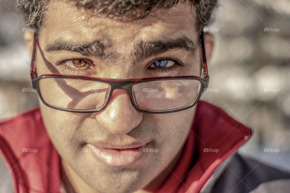 Different colored eyes