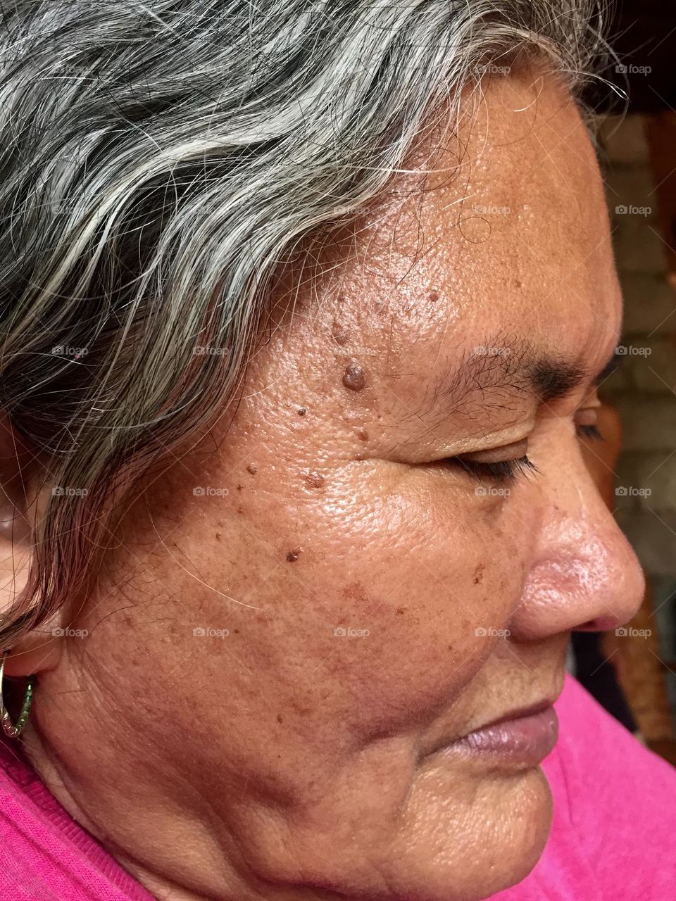 Old woman’s skin 