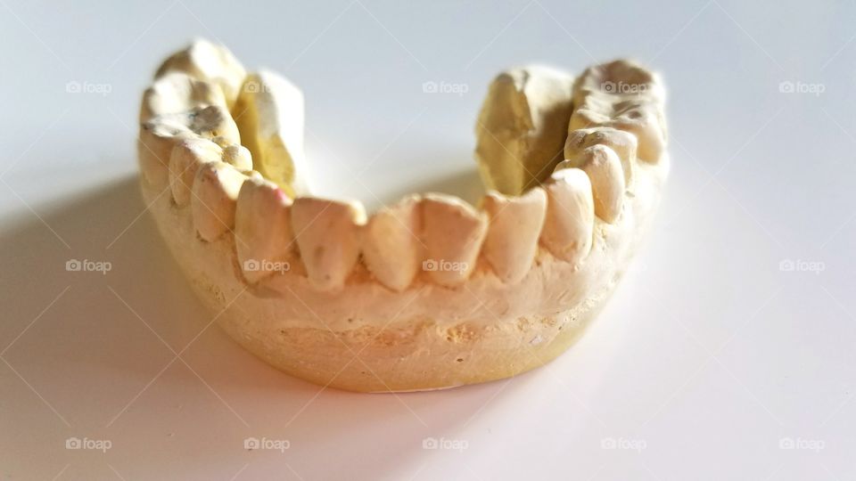 Dental impressions