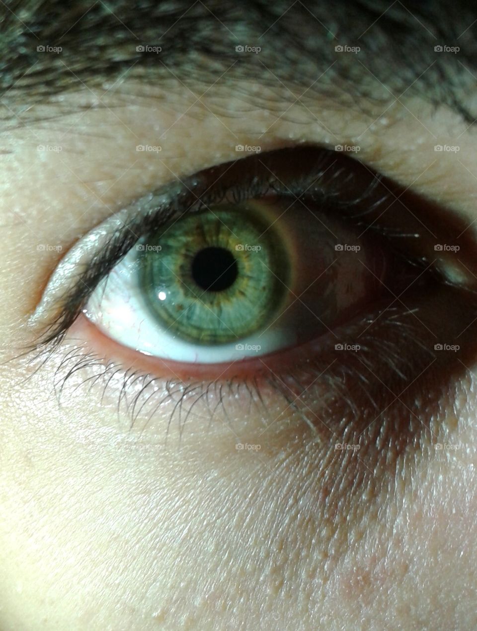 Green iris