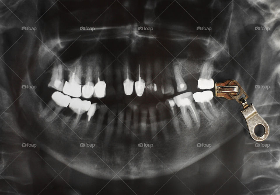 Metal zipper on x-ray picture of teeth. Keeping silence!