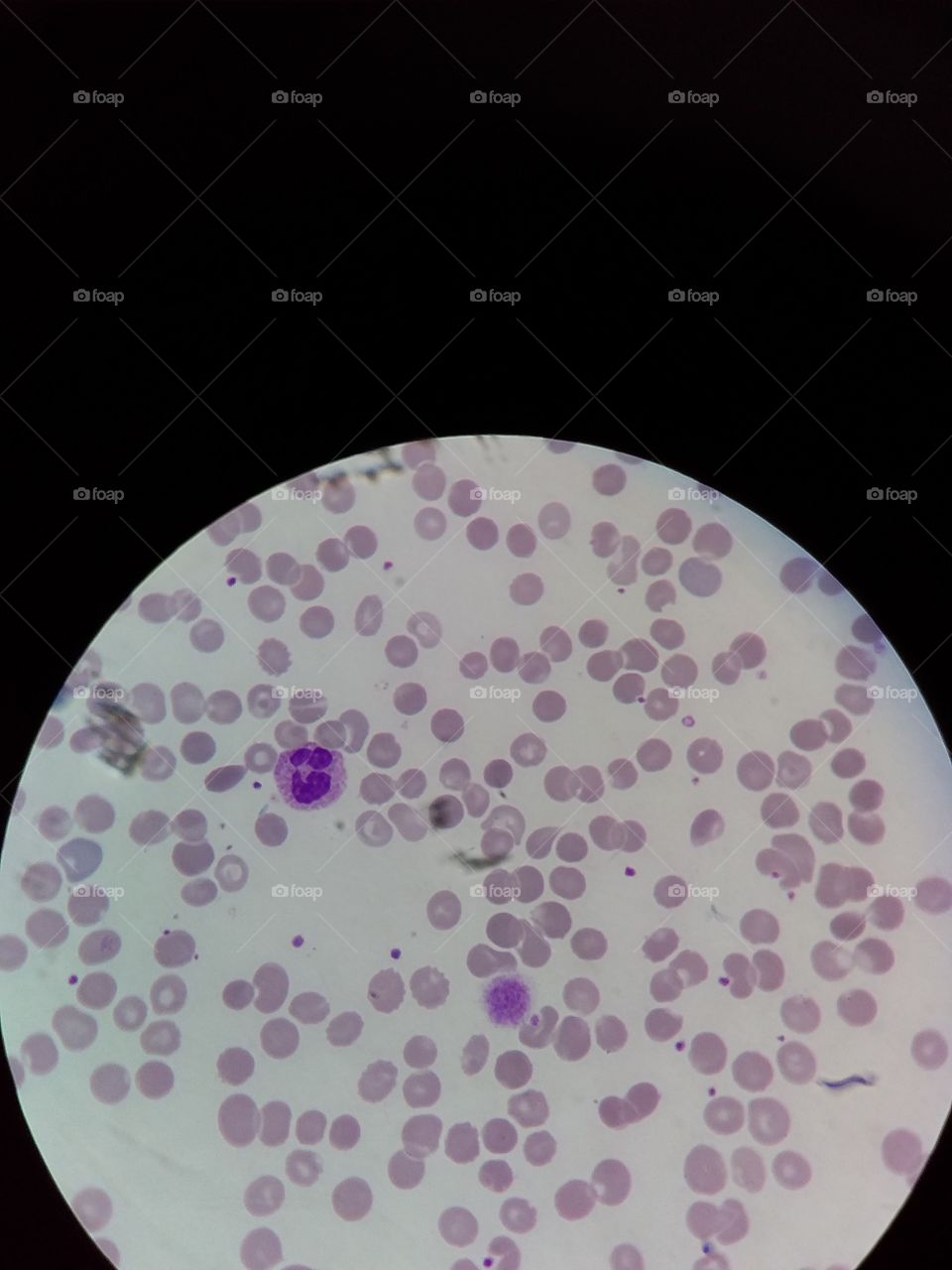 platelets/cell blood