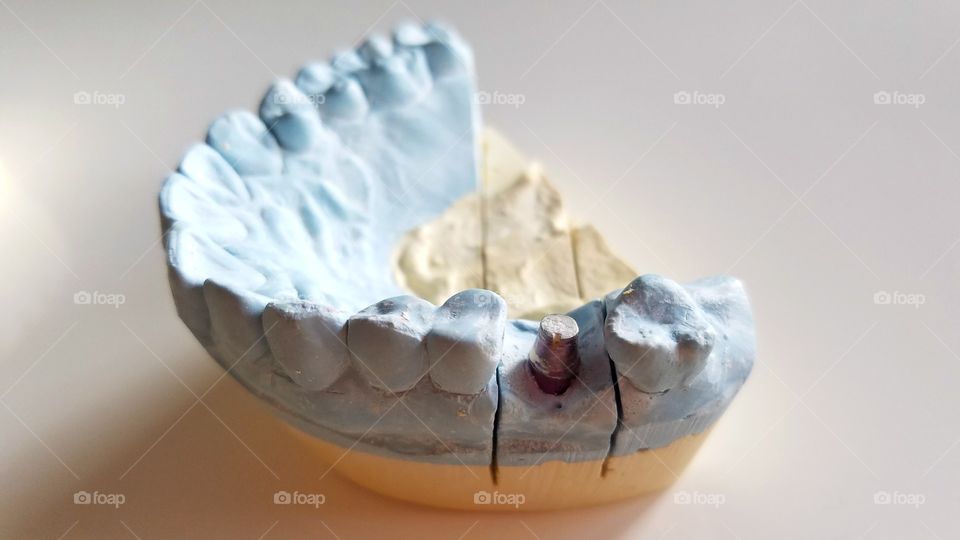 Dental impressions