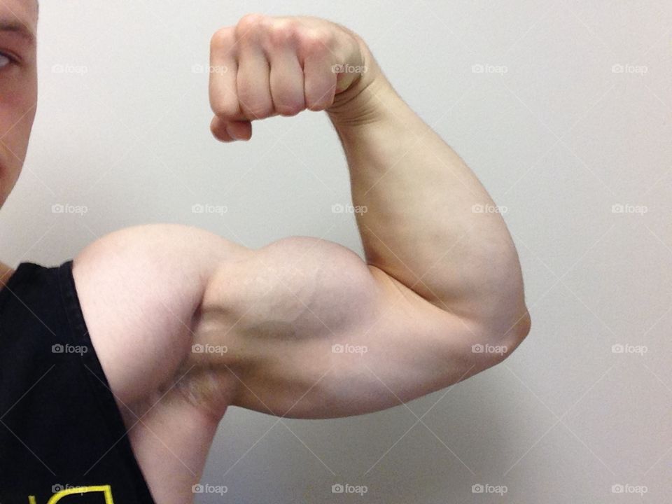 Bicep