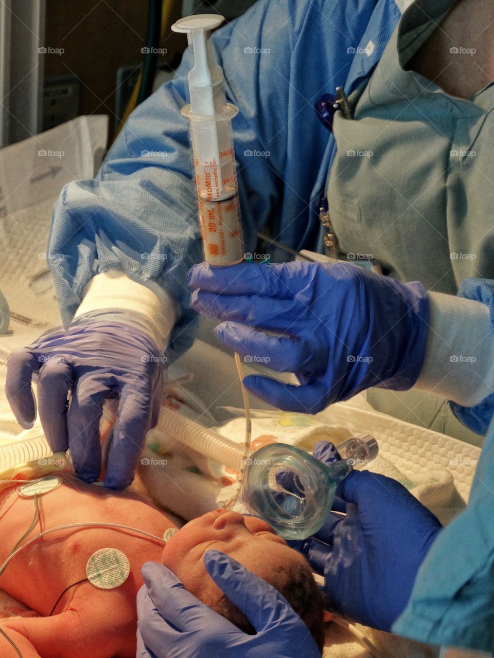 Premature Infant In Intensive Care
