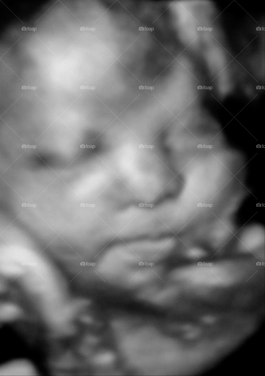 3-D Ultrasound shows babies facial features in black and white 