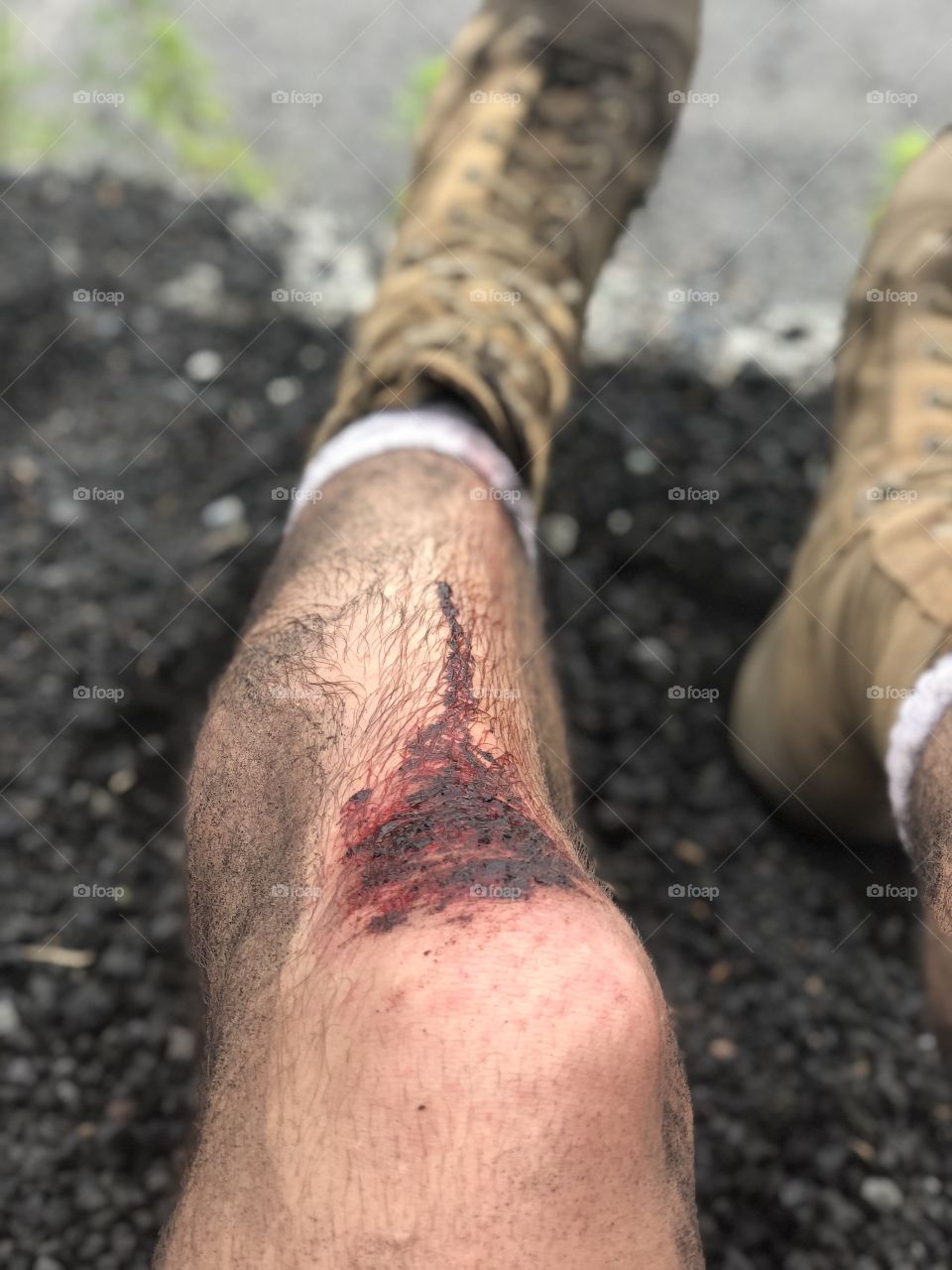 What happens when you sprint down a mountain 