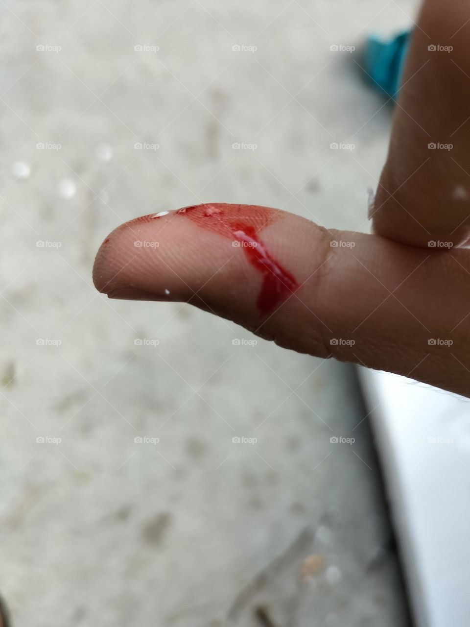 picture of a hand bleeding from a wound
