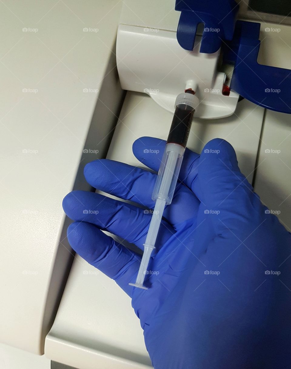 Blood analysis in the laboratory. A hand in a blue glove holding a vial of blood during testing