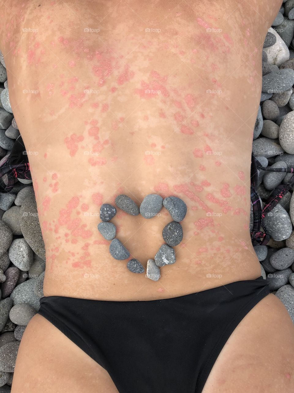 I’m insecure about my back but my insecurities don’t hold me back. Confidence at the beach. Skin mosaic. Looking out and looking within. Rocky coast.