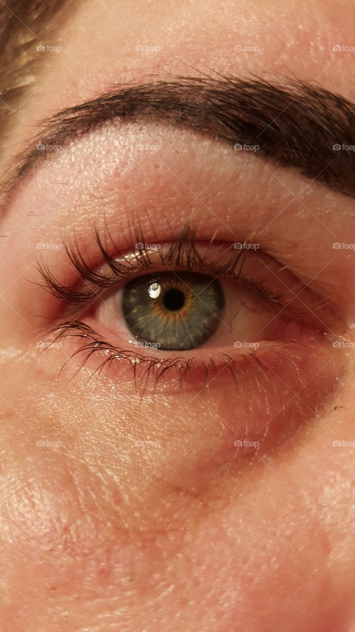 Central Heterochromia Female Eye