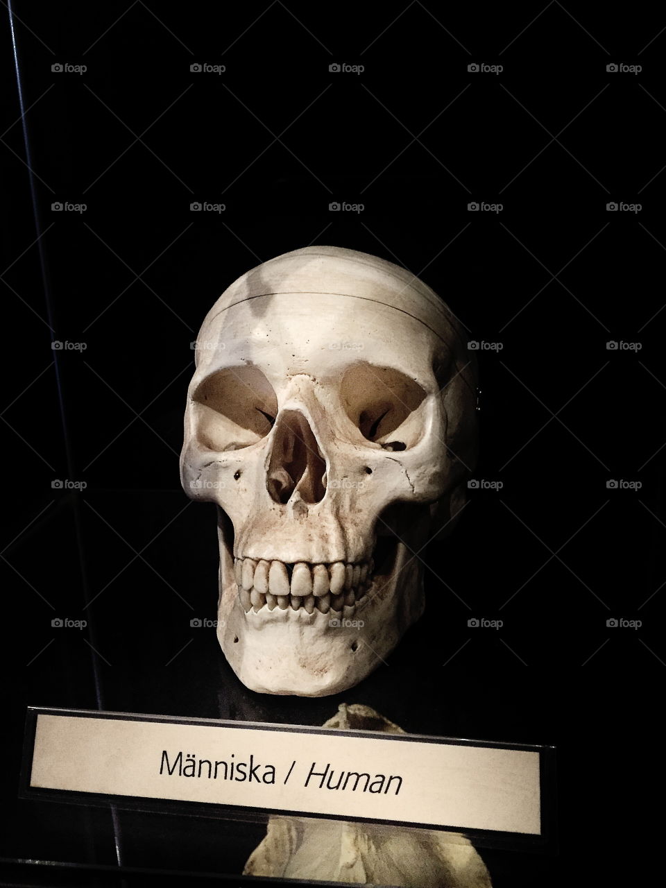 Human skull
