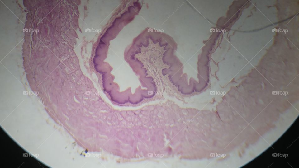 Intestines under microscope