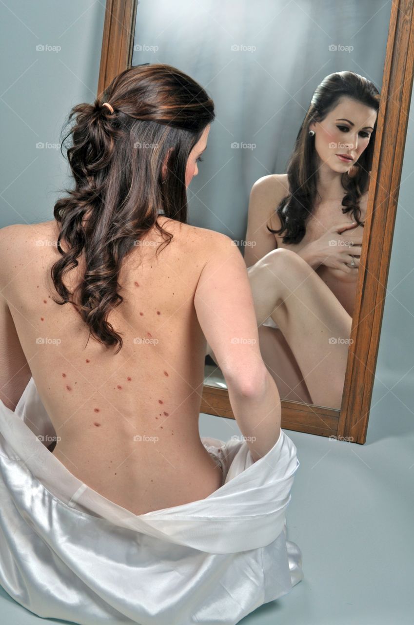 Reflection of a woman in mirror with pigmentation on her back