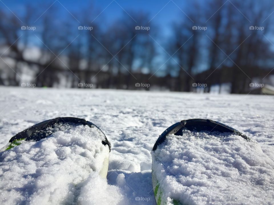 Close up of skis with blue sky and forest in the background 