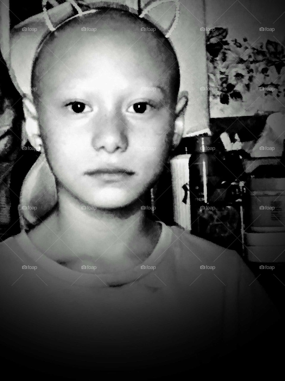 Little girl after getting her shaved for the first time due to Alopecia.