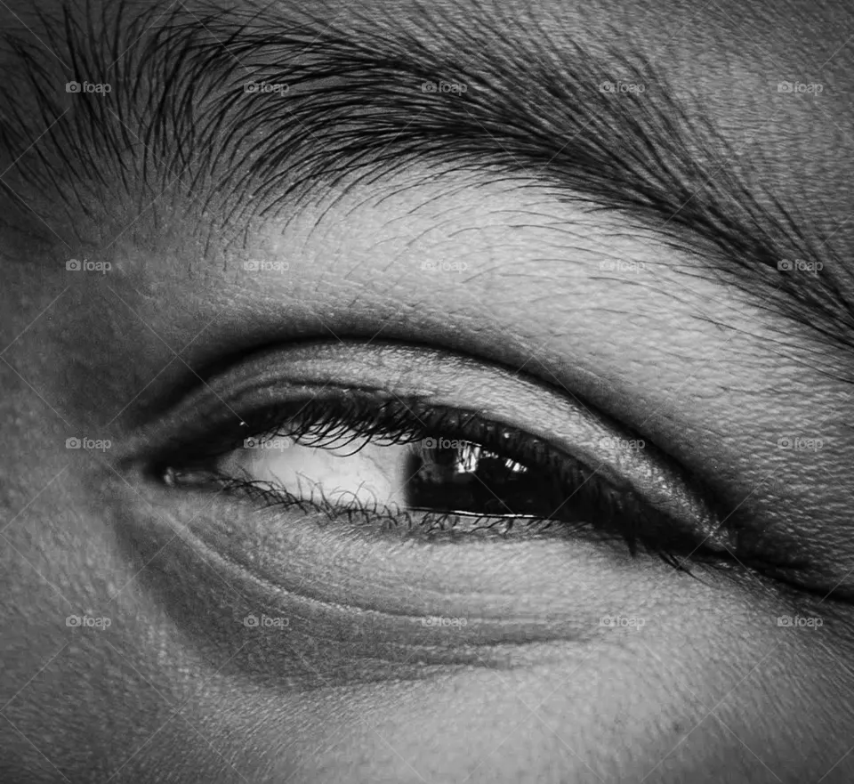 Eye 