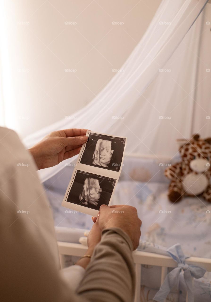 Couple hold onto the ecography picture of their unborn baby boy, while patiently waiting beside his bed