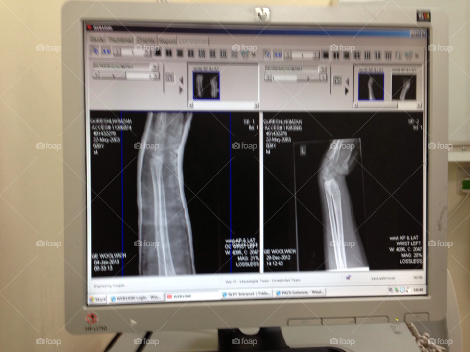 Radiography, Hospital, Technology, Scrutiny, Medicine