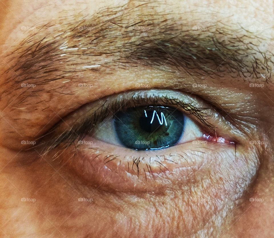 Lightning in the eyes