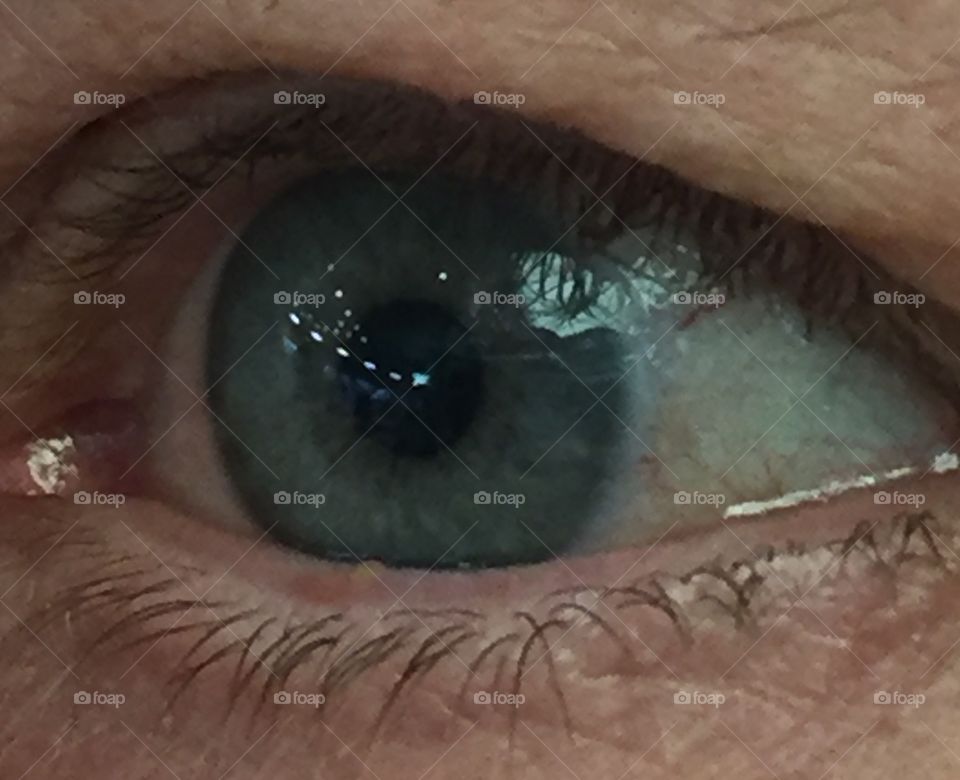 Eye with ice
Magical iris