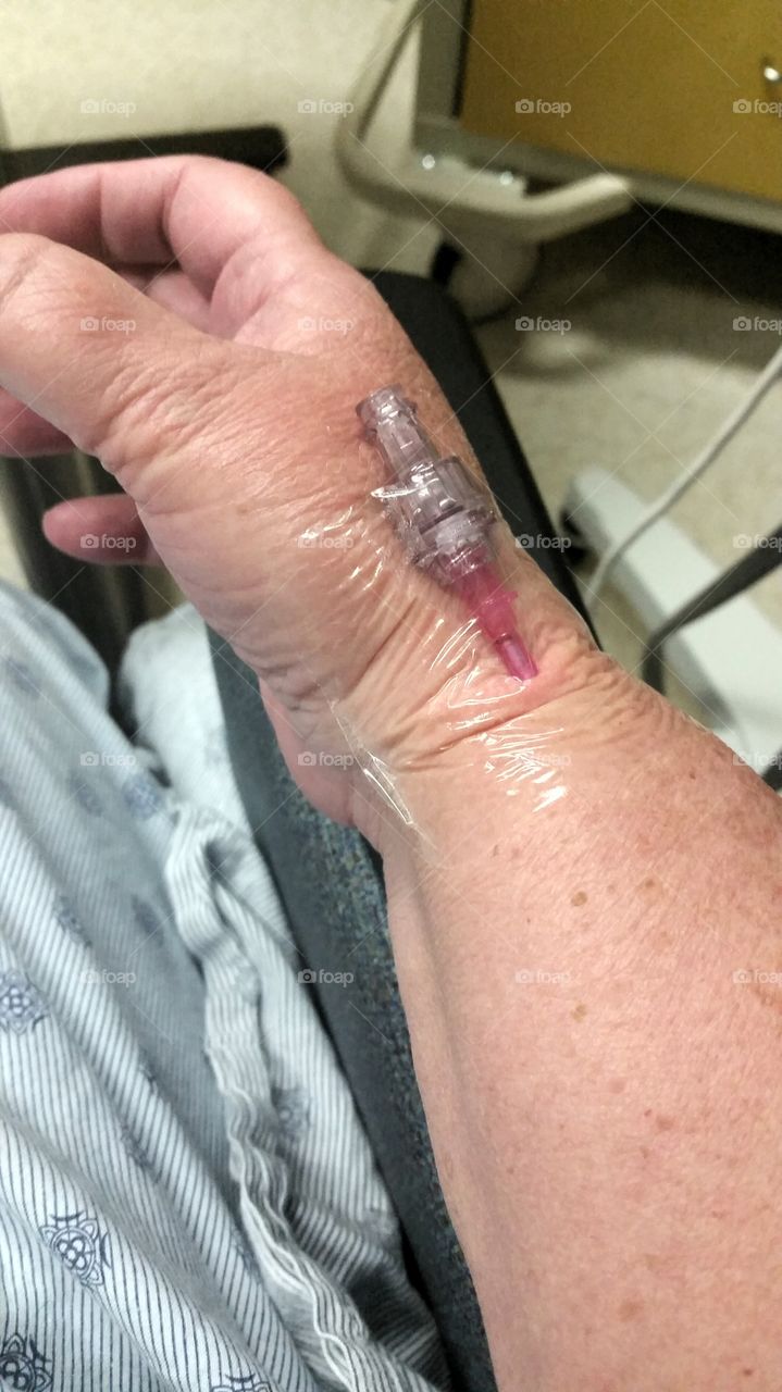 IV in the wrist