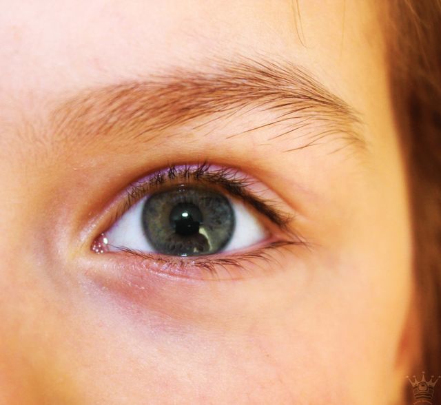 Blue eye