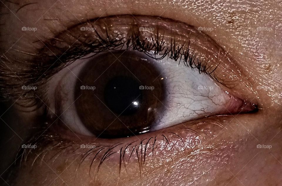 Eye