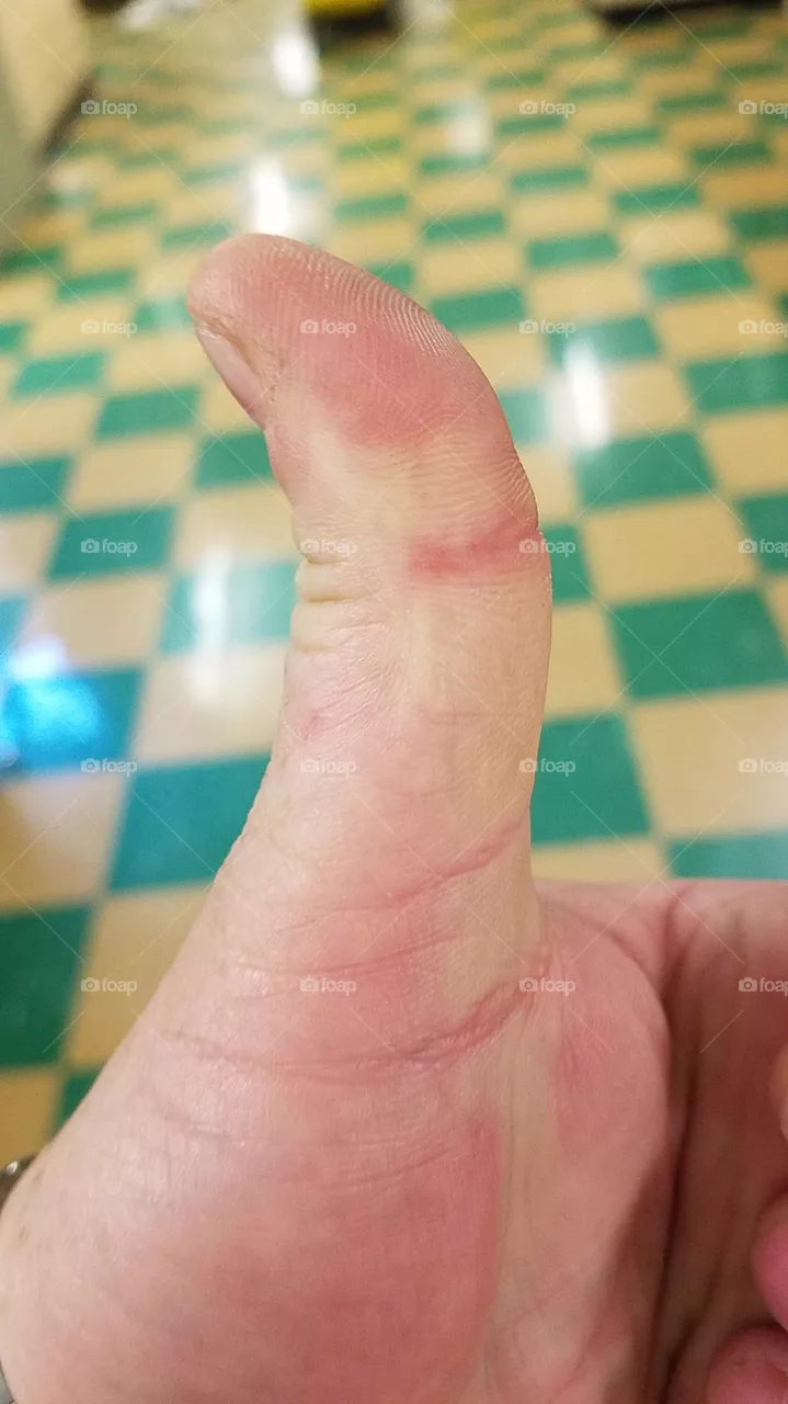 thumbs up