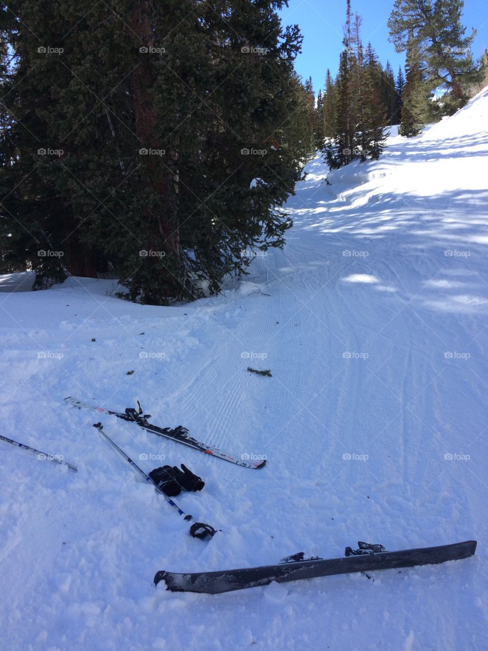 Ski mishap 