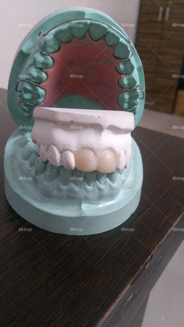 Creepy braces teeth models