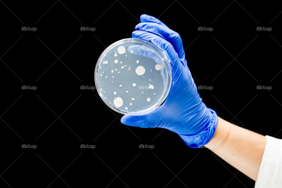 Close up of scientist hand with bacteria culture on Petri dish