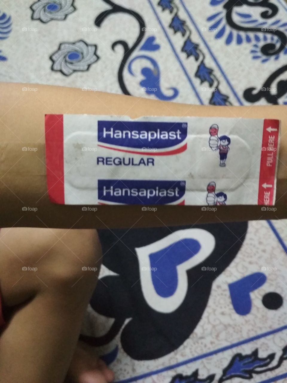 Handplast