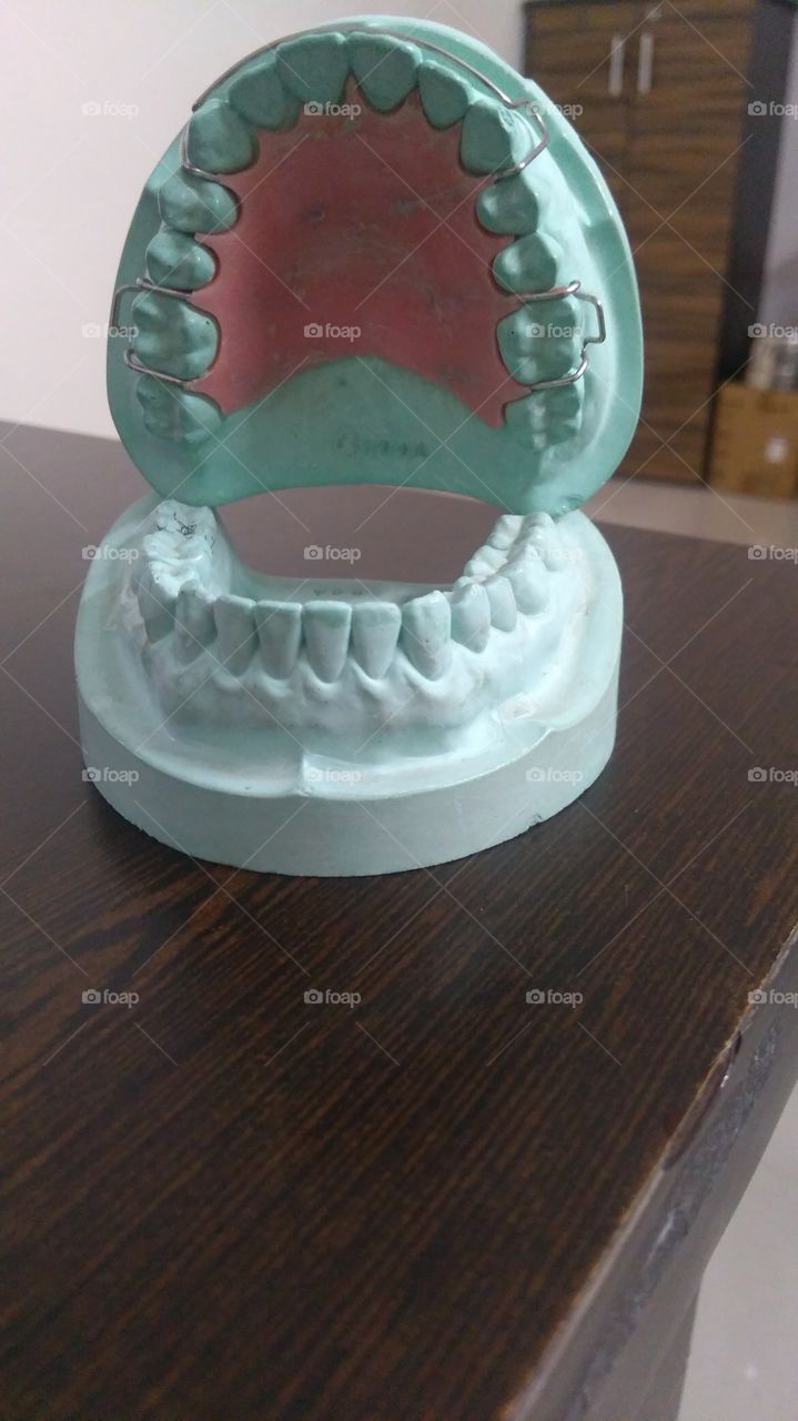 Teeth braces Model