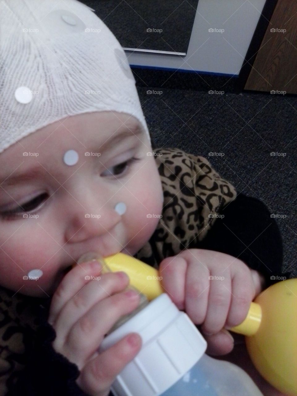 sis in her helmet. we kicked plagiocephaly's butt