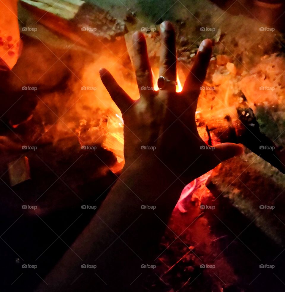 burning hand