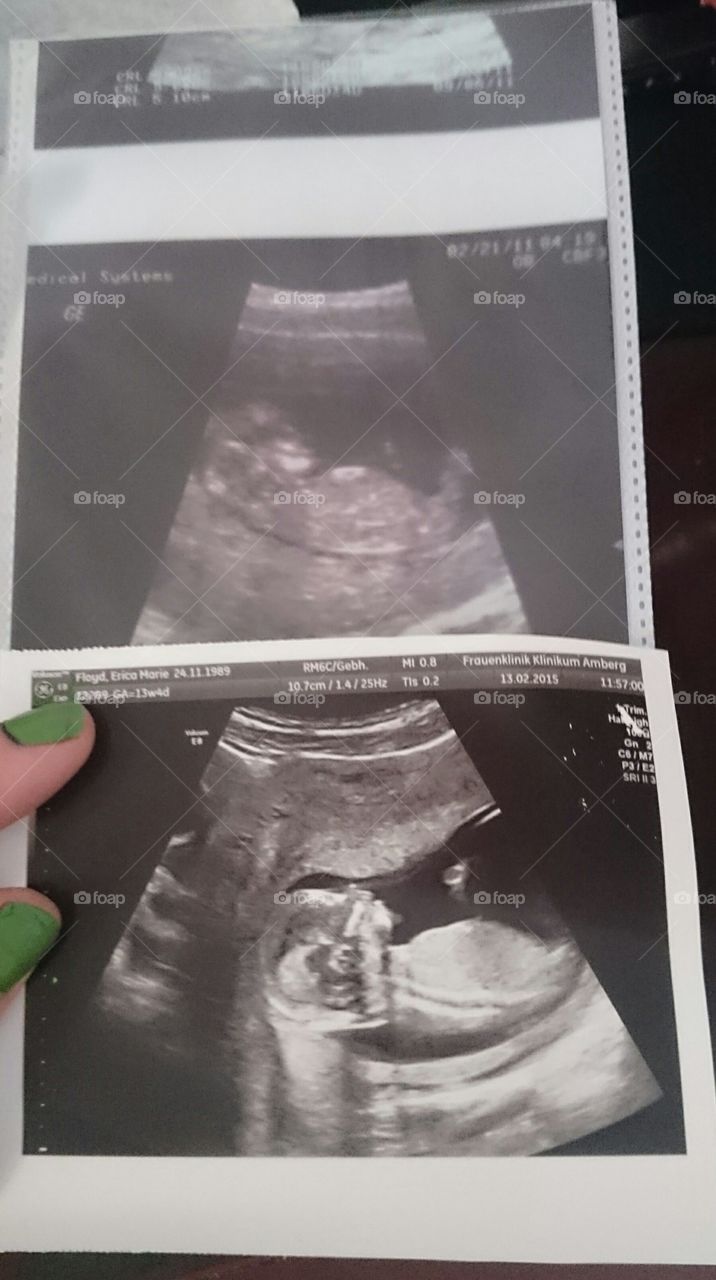 ultrasound pics . my babies 