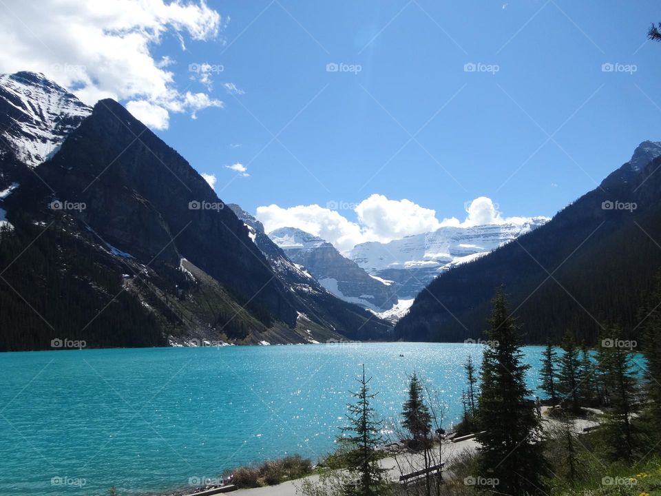 Azure Serenity: Captivating Views of Lake Louise with Clear sky and Pristine Waters