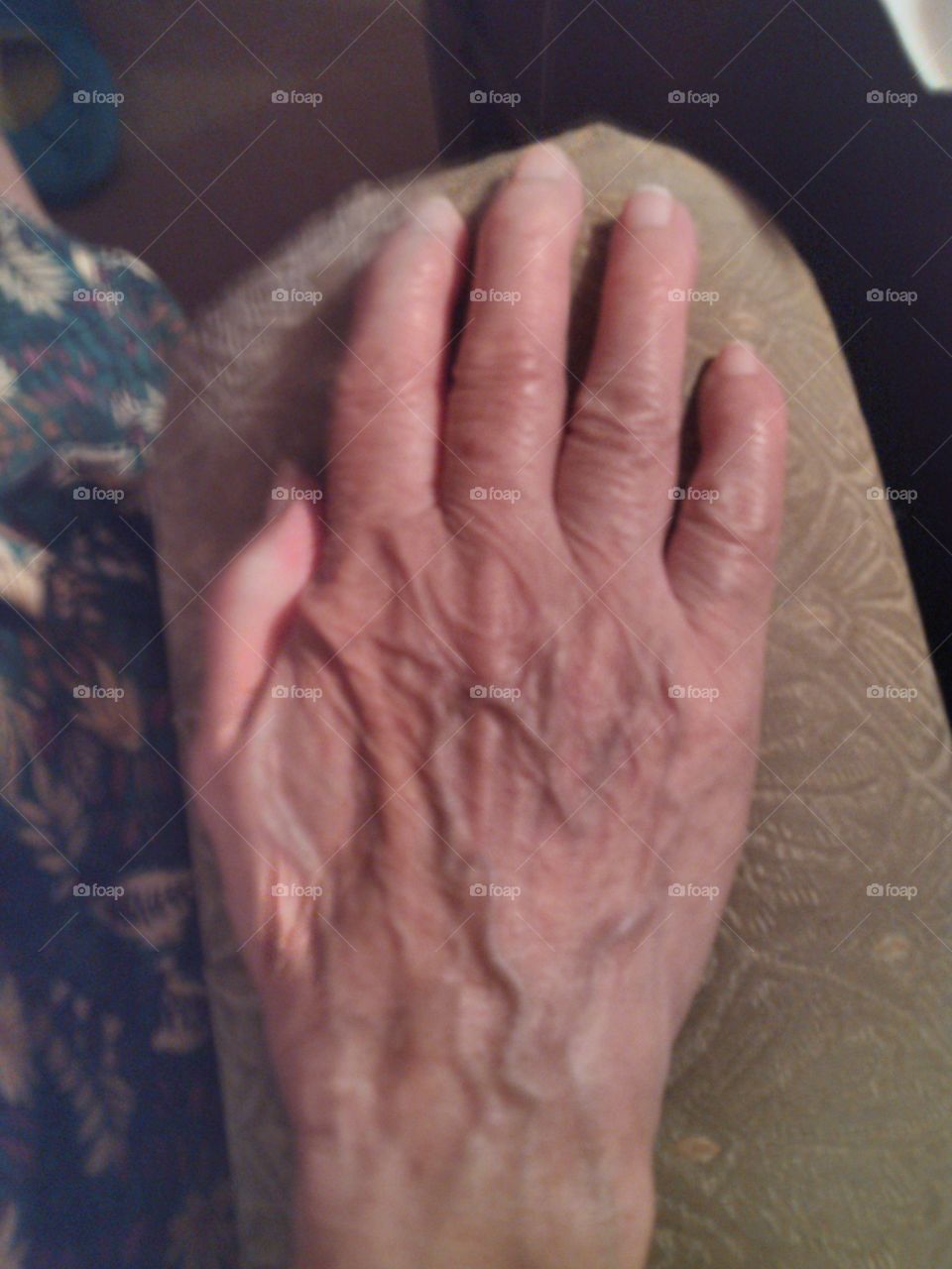 aging hand