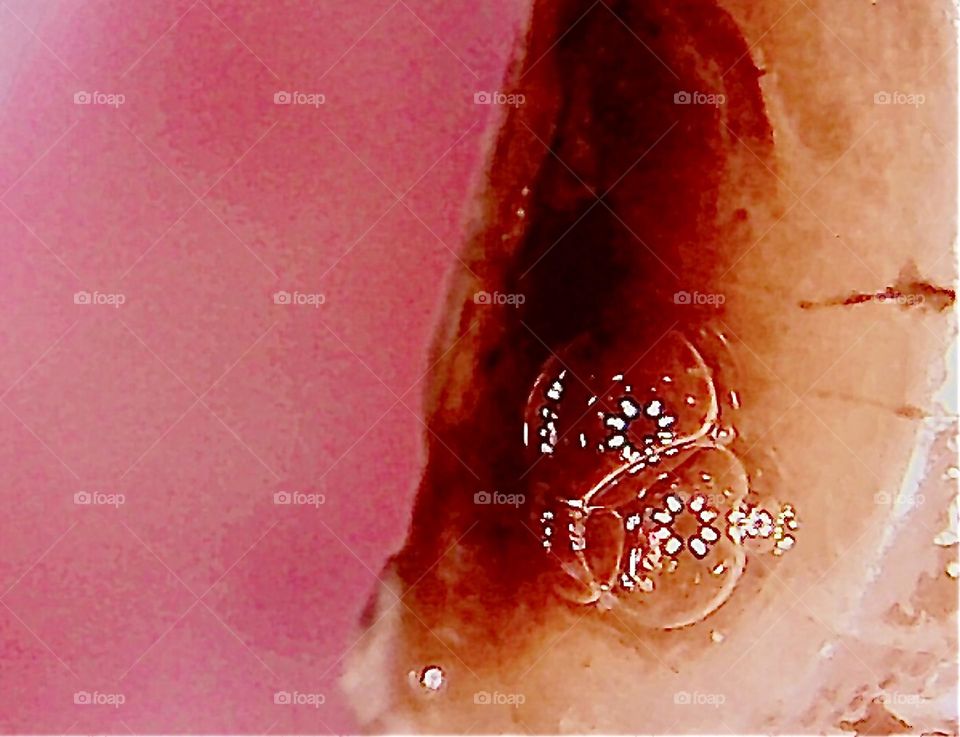 This photo shows where the previous one came from. To the left gums & to the right two teeth w a cavity in between. The circular LED lights of a USB microscope camera at 120 x magnification reflect in the bubbles of saliva. 2016. Hypnotic Productions